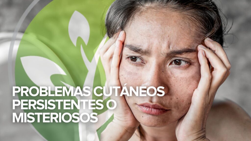 Martes de testimonios: Problemas cutáneos persistentes o misteriosos Martes de testimonios: Problemas cutáneos persistentes o misteriosos
