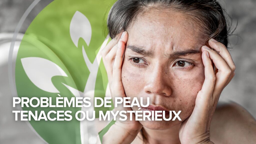 Témoignage du mardi : Problèmes de peau tenaces ou mystérieux
