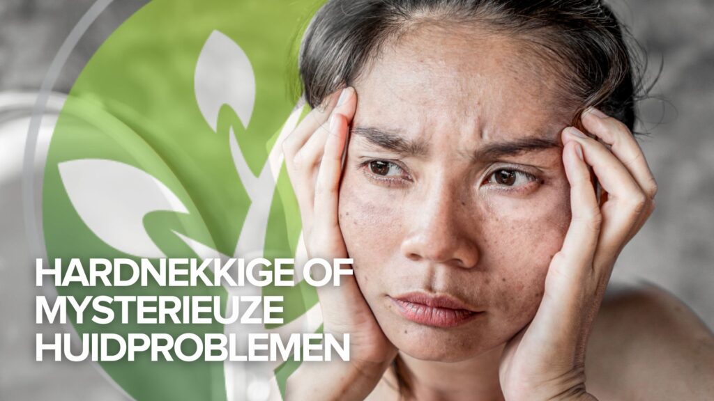 Getuigenis dinsdag: Hardnekkige of mysterieuze huidproblemen Getuigenis dinsdag: Hardnekkige of mysterieuze huidproblemen