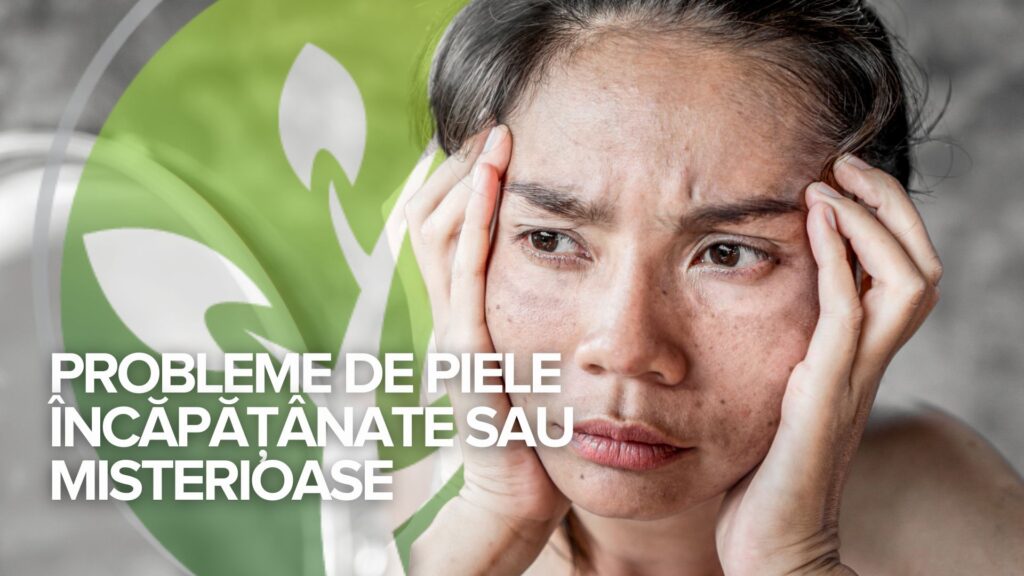 Mărturii marți: Probleme de piele încăpățânate sau misterioase Mărturii marți: Probleme de piele încăpățânate sau misterioase