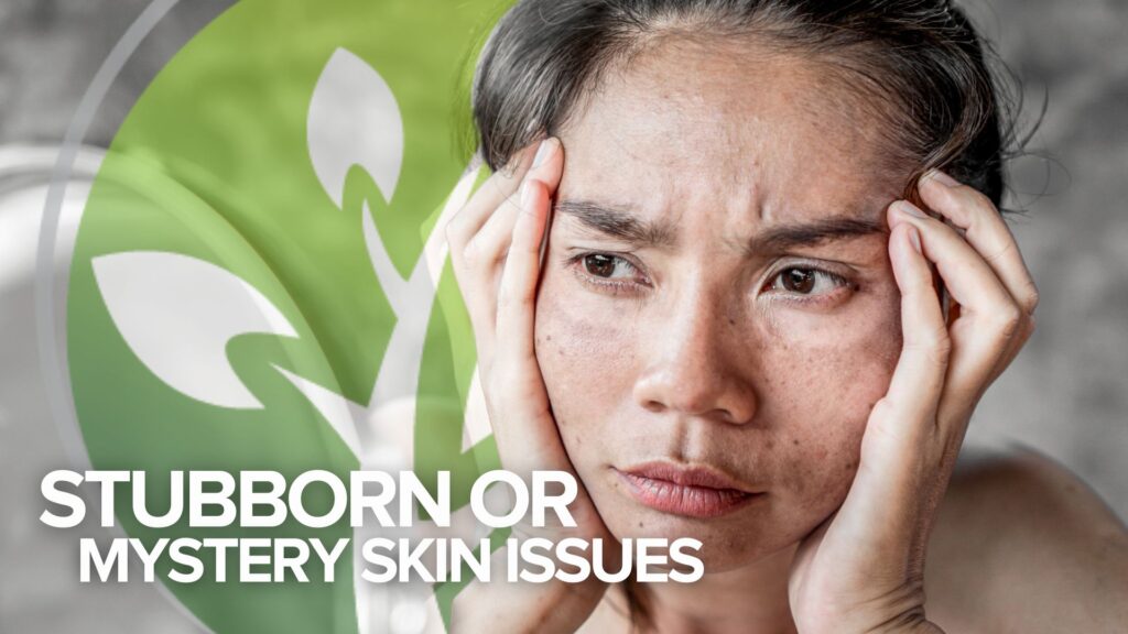Testimonial Tuesday: Stubborn or Mystery Skin Issues Testimonial Tuesday: Stubborn or Mystery Skin Issues