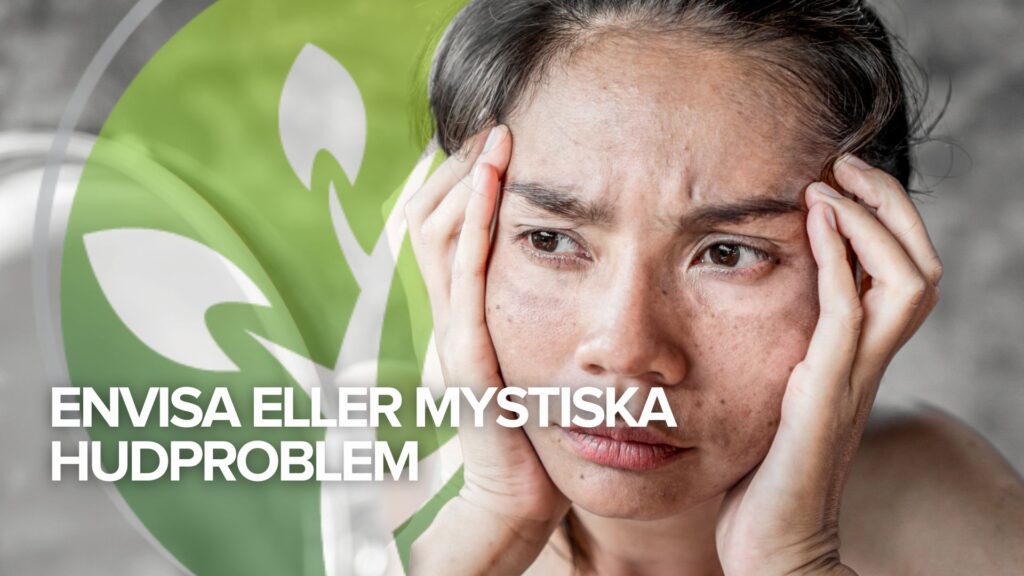 Testimonial tisdag: Envisa eller mystiska hudproblem Testimonial tisdag: Envisa eller mystiska hudproblem